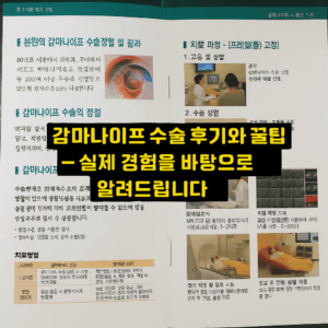 감마나이프 수술비